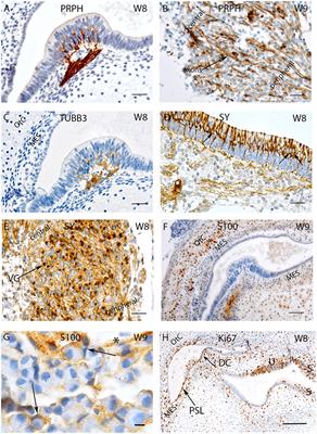 Neurosensory Differentiation and Innervation Patterning in the Human Fetal Vestibular End Organs between the Gestational Weeks 8–12